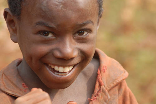 burundi africa pediatria bcc