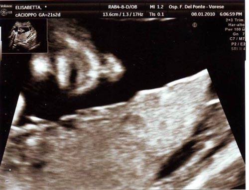 elisabetta cacioppo, facebook