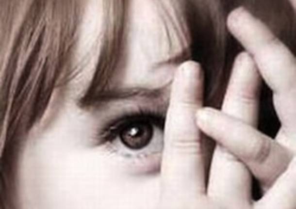 sindrome di rett apertura