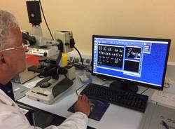 Ricerca delle cause genetiche dell'autismo