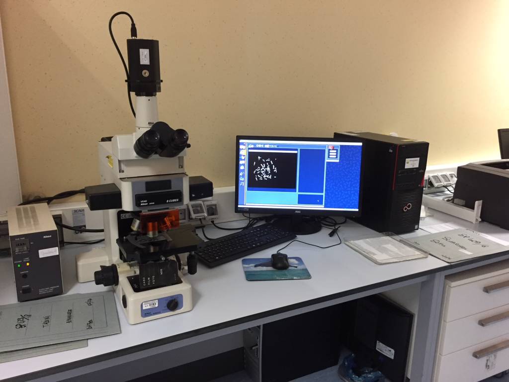 Ricerca delle cause genetiche dell'autismo