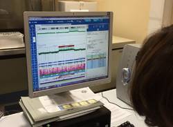 Ricerca delle cause genetiche dell'autismo