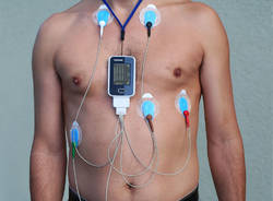 holter ecg