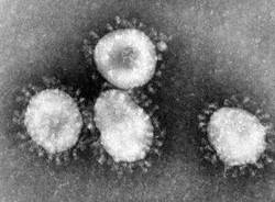 coronavirus