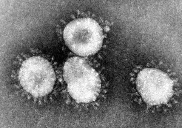 coronavirus