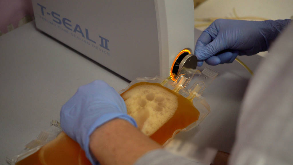 La ricerca sul Plasma Iperimmune a Varese