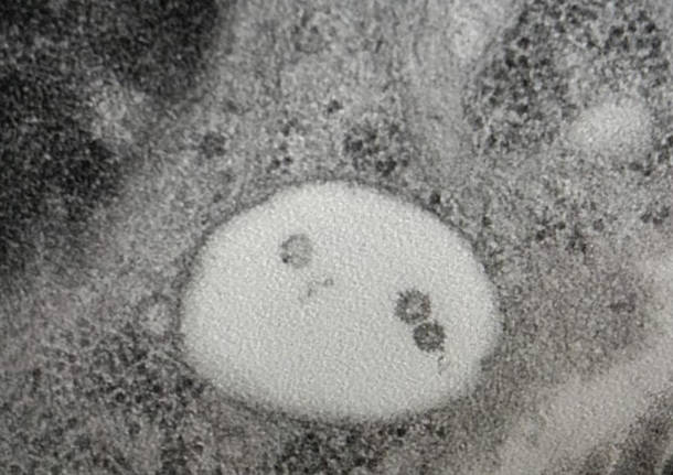 virus