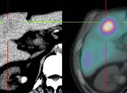 radiologia interventistica