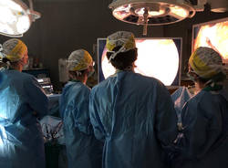 Sala operatoria - chirurgia Baldazzi - chirurgia guidata da fluorescenza - Legnano