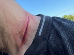 cappio acciaio bosco ferito endurista luglio 2023